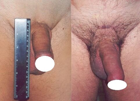 Before and after the penis go